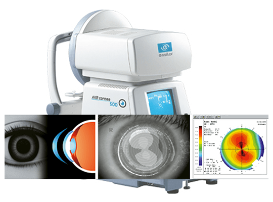 AKR Cornea 500 2
