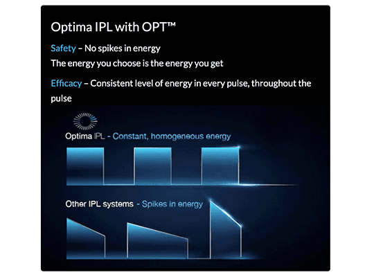 M22 IPL OPT 3