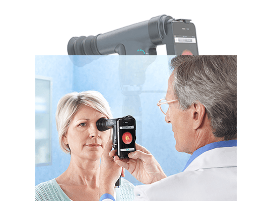 אופטלמוסקופ PanOptic iExaminer 2