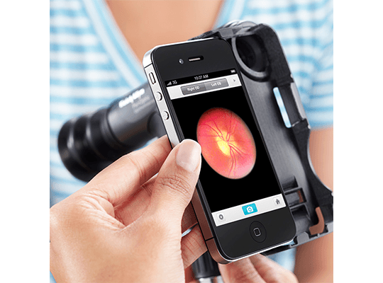 אופטלמוסקופ PanOptic iExaminer 3