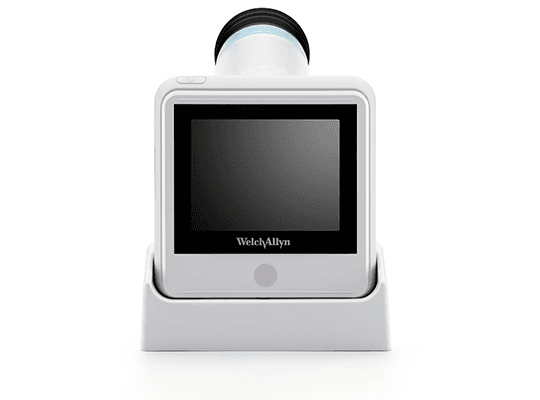 RetinaVue 100 2
