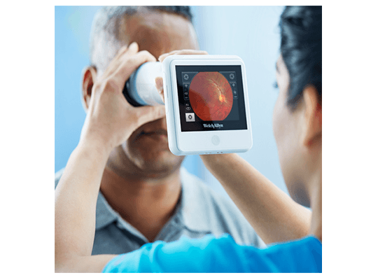 RetinaVue 100 5