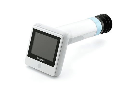 RetinaVue 100 PRO 2