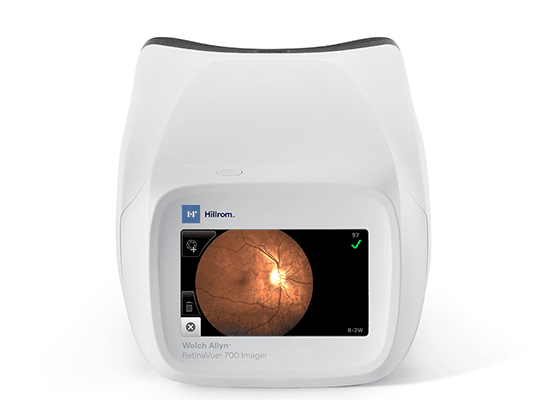 RetinaVue 700 2